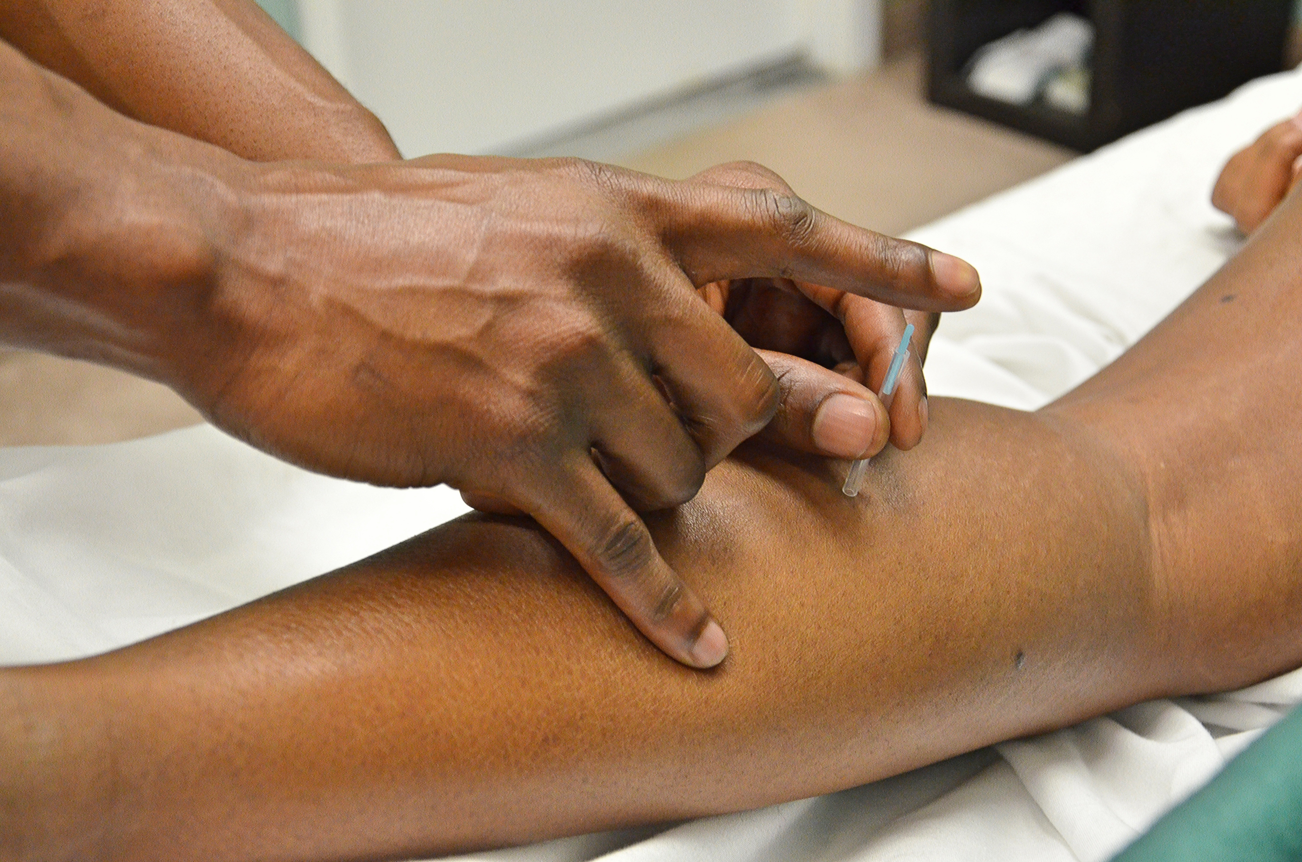 Dry Needling India