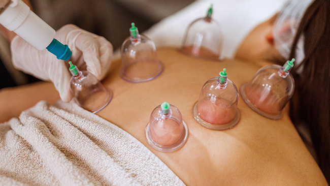 Cupping India